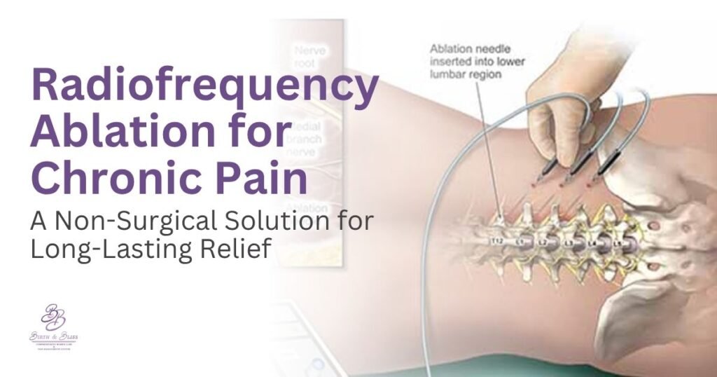 Radiofrequency Ablation for Chronic Pain – A Non-Surgical Solution for Long-Lasting Relief